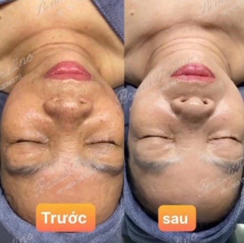 Rf căng bóng trắng da 