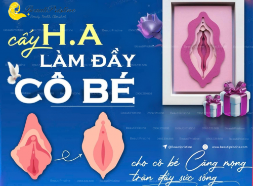 Cấy Ha Tạo Hình Cô Bé 