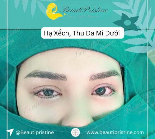 Hạ Xếch, Thu Da Mi Dưới 