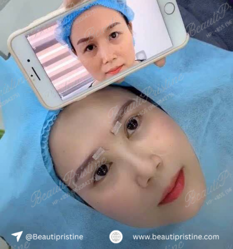 Nâng Cung Chân Mài 