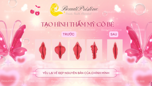 Tạo Hình Môi Bé 