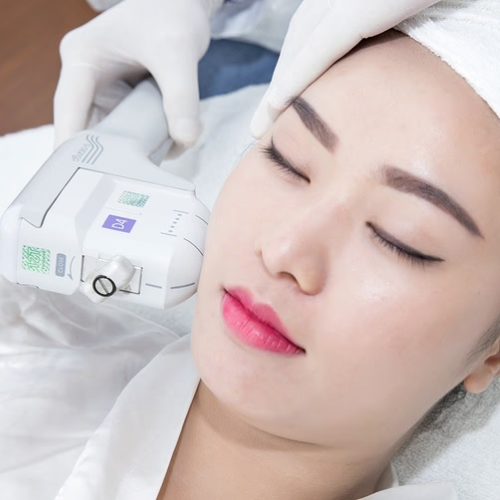 HIFU & RF NÂNG CƠ TAN MỠ 