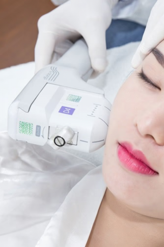 RF VÀ HIFU NÂNG CƠ, TAN MỠ 