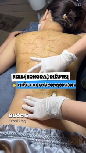 PEEL LƯNG TẢO XANH