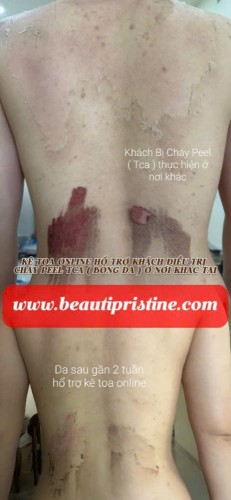 KÊ TOA ONLIEN HỖ TRỢ KHÁCH HÀNG