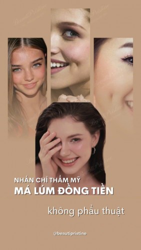Tạo Má Lúm Đồng Tiền 