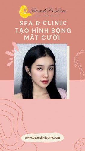 TIÊM BỌNG MẮT CƯỜI