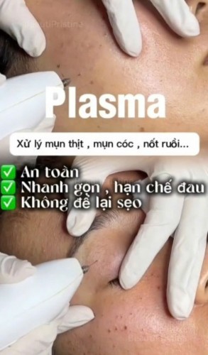 PLASMA ĐIỀU TRỊ THẨM MỸ DA